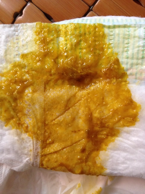 黏液便宝妈们帮帮忙