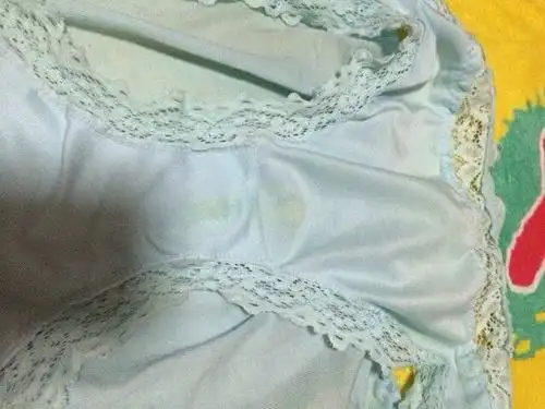 求别删图,怎么会有这样黄绿色的白带呢.