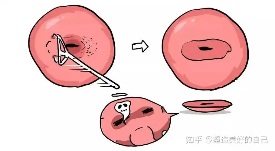 子宫为什么长息肉 子宫为什么会长息肉