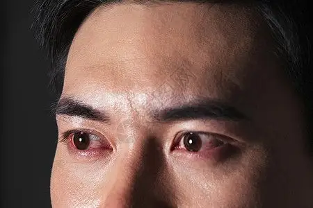 模特 哭青年男性哭红的双眼背景