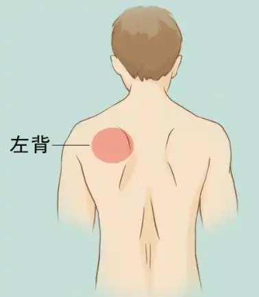 后背疼与多种病有关!一张「疼痛位置图解」看得明明白白!