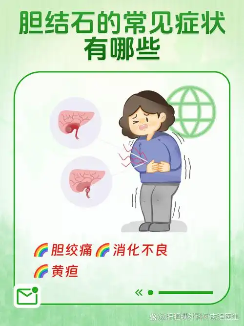 1,胆绞痛:这是胆结石最典型的症状之一.当结石在胆囊内移动或