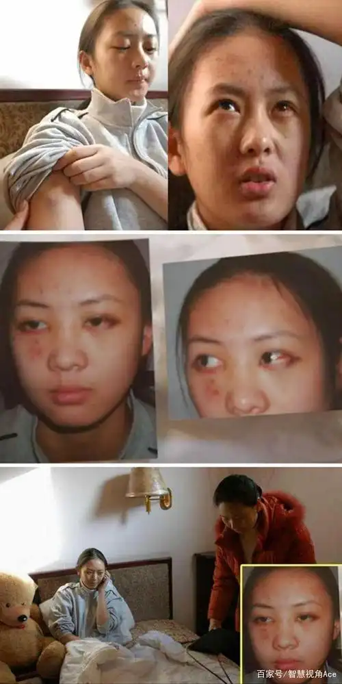 张默谈童瑶:打人是有原因的,换做是你,肯定比我更激烈