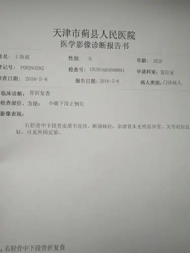 35岁,女,右小腿胫骨下段三分之一处骨折石膏托固定25天了,21天复查一