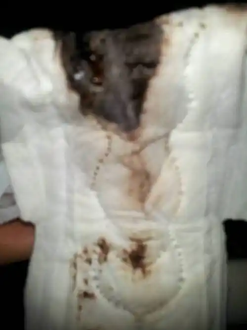 月经,昨天游泳之后发现的,昨天上午zw一次,我来的比较晚,初潮七月一日