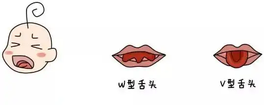 初哆咪育儿:忽视这点宝宝说话很艰难!_舌头