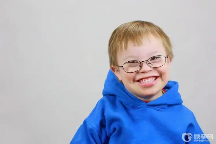 唐氏综合征患者有生育能力吗?这五大风险你不得不知!