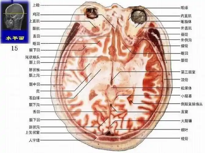 颅脑解剖图谱ppt