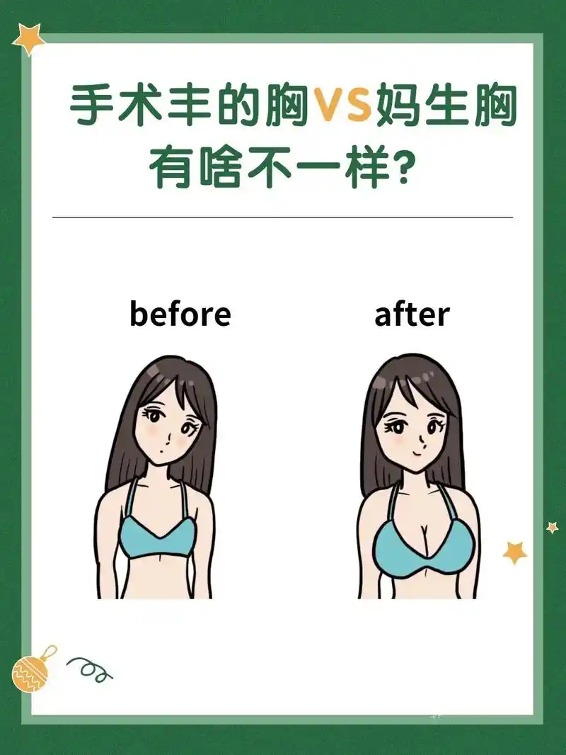 隆胸vs真胸,有啥区别?94.#刘燕亦挺品牌官方课堂  说起 - 抖音