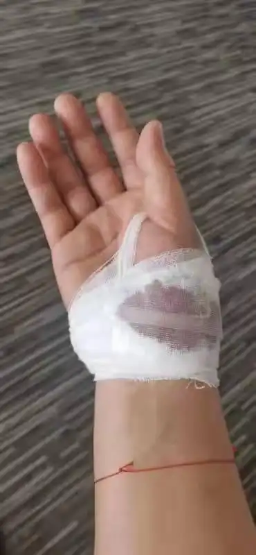 受伤交警吴长虹 图片均为警方提供此后,有人看到吴长虹的手部鲜血直流