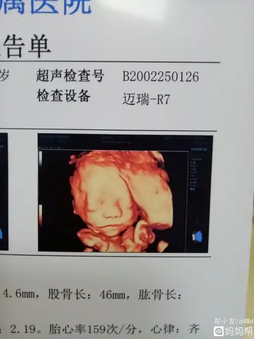 四维看男孩女孩诀窍四维彩超单