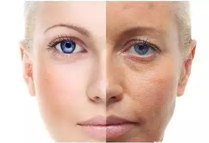 干细胞美容抗衰老,肌肤保持年轻的秘密!