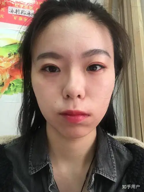 左右脸不对称怎么办?(带图)?