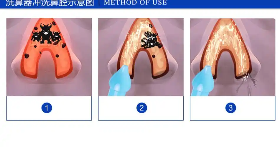 艾尔电动洗鼻器 成人儿童鼻炎鼻腔冲洗器 喷雾盐水洗鼻壶鼻子送盐
