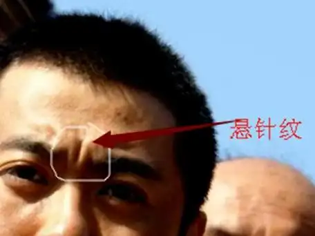 额头男人有倒八字纹 额头有八字纹怎么办 - 汽车时代网