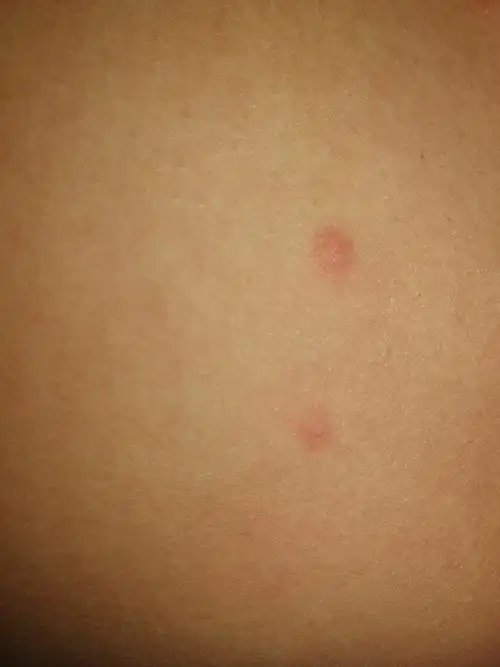 帮忙看看这是什么病