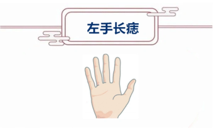 "左手痣,能进财,手背痣,主财巧",手上这四颗痣,存钱又抓财