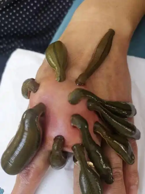 荣郁 水蛭活体蚂蟥活体菲牛蛭金边蚂蟥吸血蚂蟥活体治疗1-1.