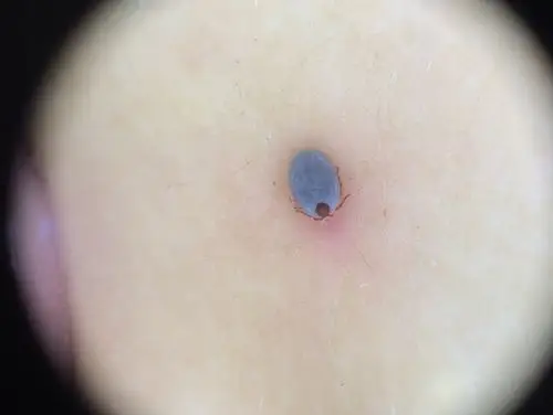 感知距离可达15 m.蜱虫的幼虫,若虫和成虫都可吸血,饱血后就脱离宿主.