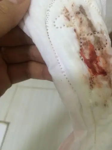 这几个月月经量少,头半天颜色正常.