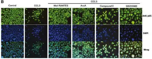 关于文献中免疫荧光的图的理解求助