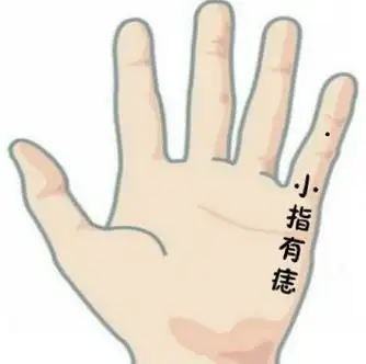 女人小指上有痣代表什么 小指有痣解析_达一风水网