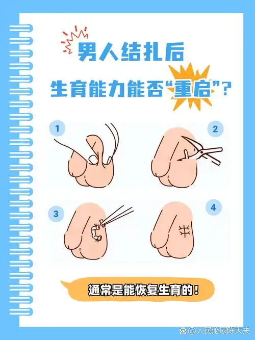 但生活中总会有各种新的情况和需求出现,越来越多做过结扎手术的男性