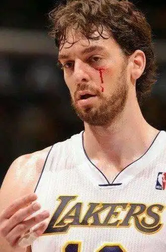 盘点nba赛场上的那些流血镜头