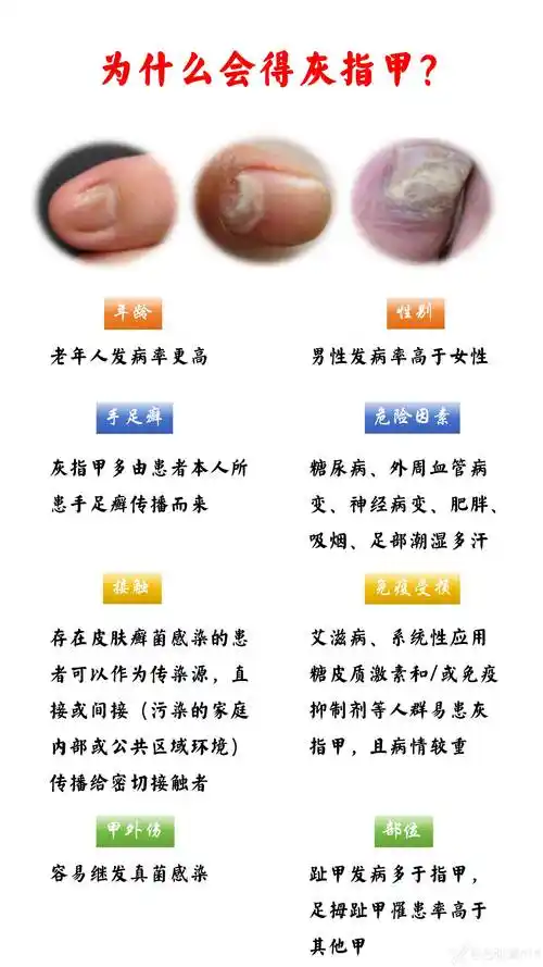 一起来认识熟悉又陌生的灰指甲