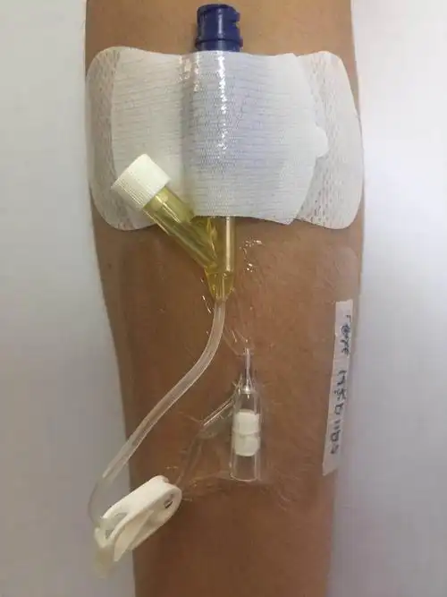 链接生命的通路～静脉输液 - 美篇