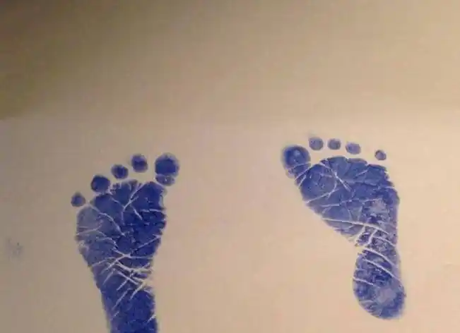 为何医院要收集刚出生婴儿的"脚印"?医生不说,做父母的也要明白