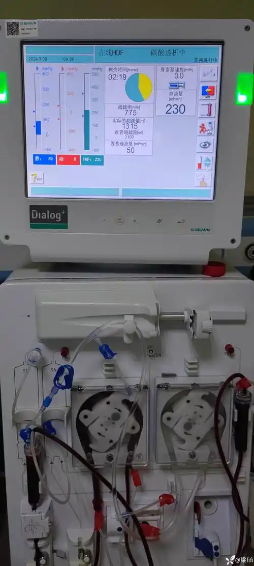 血液透析机用后体验