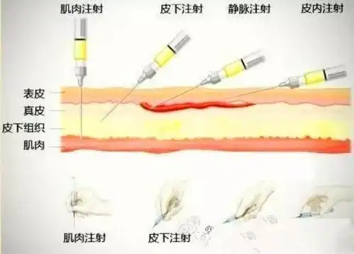 超实用扎针技巧教你一针见血