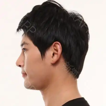 郑院长在韩国很有名气,找他做整形的人有很多,预约