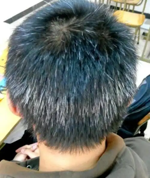 头上长了白头发,不要染色也别拔掉,跟着晓宇学起来吧