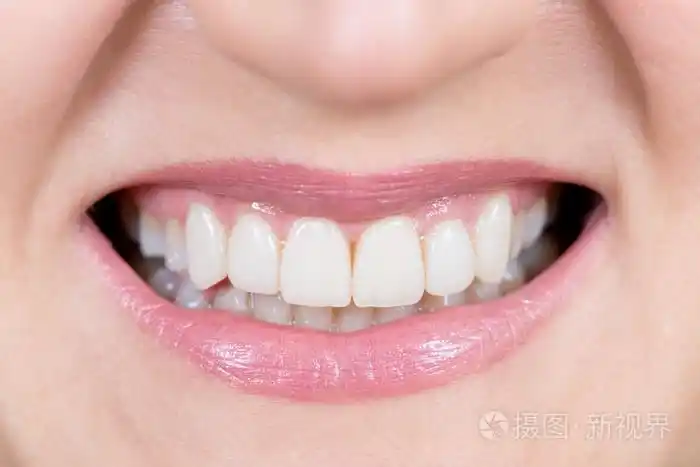 一张嘴巴和恢复的牙齿的特写