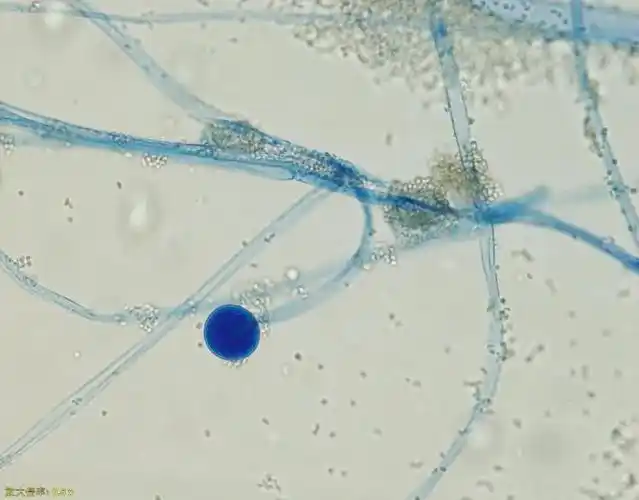 来源:网络培养基培养形态毛霉菌是一大类广泛存在于