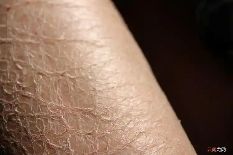 改善皮肤粗糙的方法 小腿皮肤粗糙什么原因