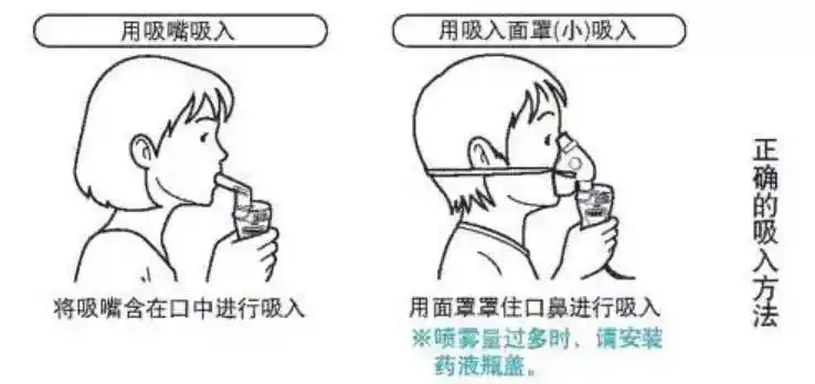 常用药:布地奈德,丙酸倍氯米松    (2)支气管舒张剂   主要作用