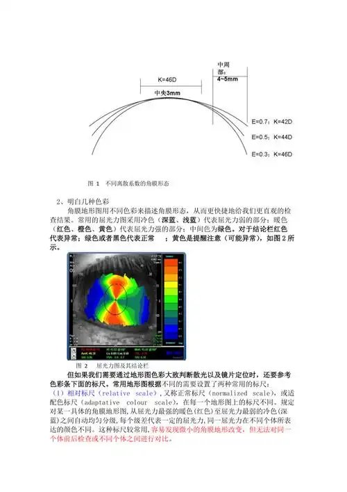 角塑验配之角膜地形图解读