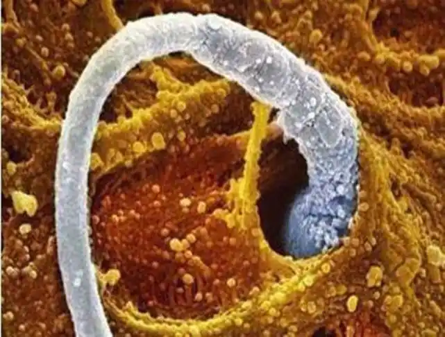 备孕女性一定要知小常识: 卵子排出时是什么感觉了?快看看