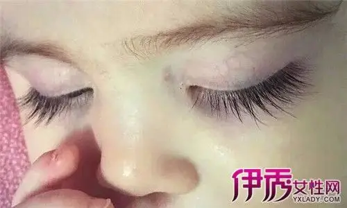 【图】孩子眼睫毛倒长图片 5大方法教你应对倒睫毛