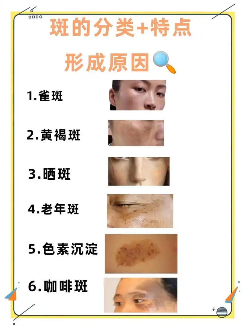 科学护肤 #淡化斑点 #斑点分类 #好皮肤都是养出来的   - 抖音