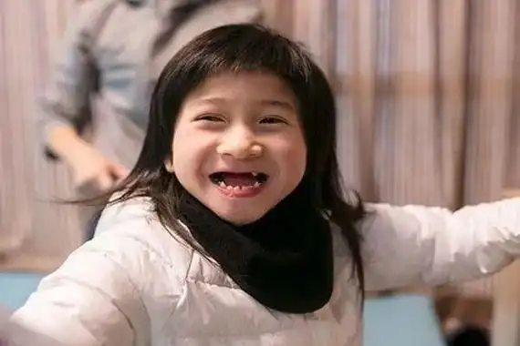 天使综合症一种看似美丽实则影响发育的疾病患者难以活到成年
