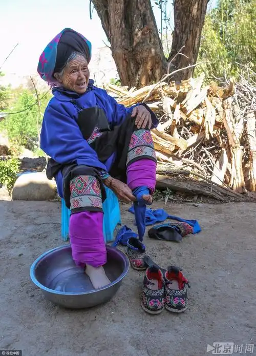 实拍最后的裹足老人"三寸金莲"脚掌已变形