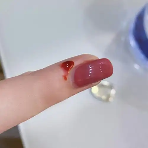 姐妹们 ,急 有没有手或者手指受伤的照片啊 想偷懒