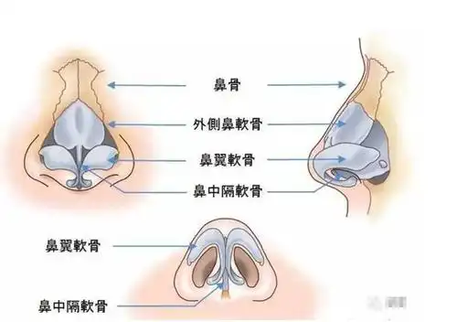 鼻头大多半是鼻子软骨发育不良该如何缩小医生详解3个步骤