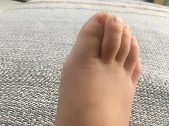 有什么影响_百科-8s新商盟