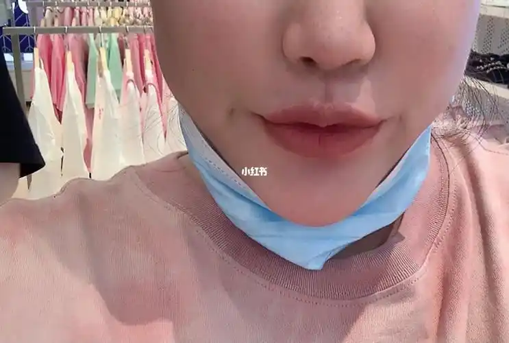 梨涡钉俩个月的效果