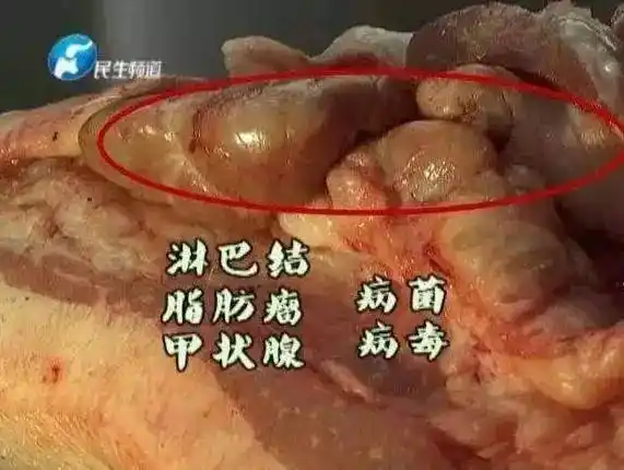 还有一个部位是更不要碰的,就是猪脖子,俗称血脖肉,或者淋巴肉